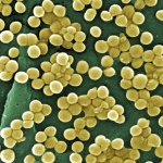 Methicillin-resistant Staphylococcus aureus (MRSA)