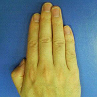 finger size may reflect penis size, says new study